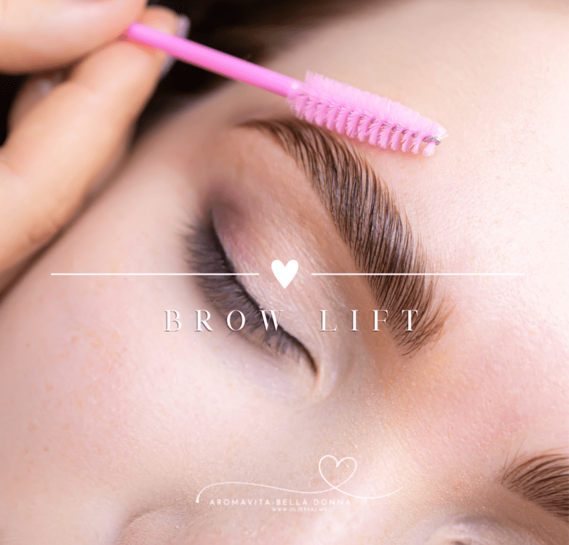 Brow lift