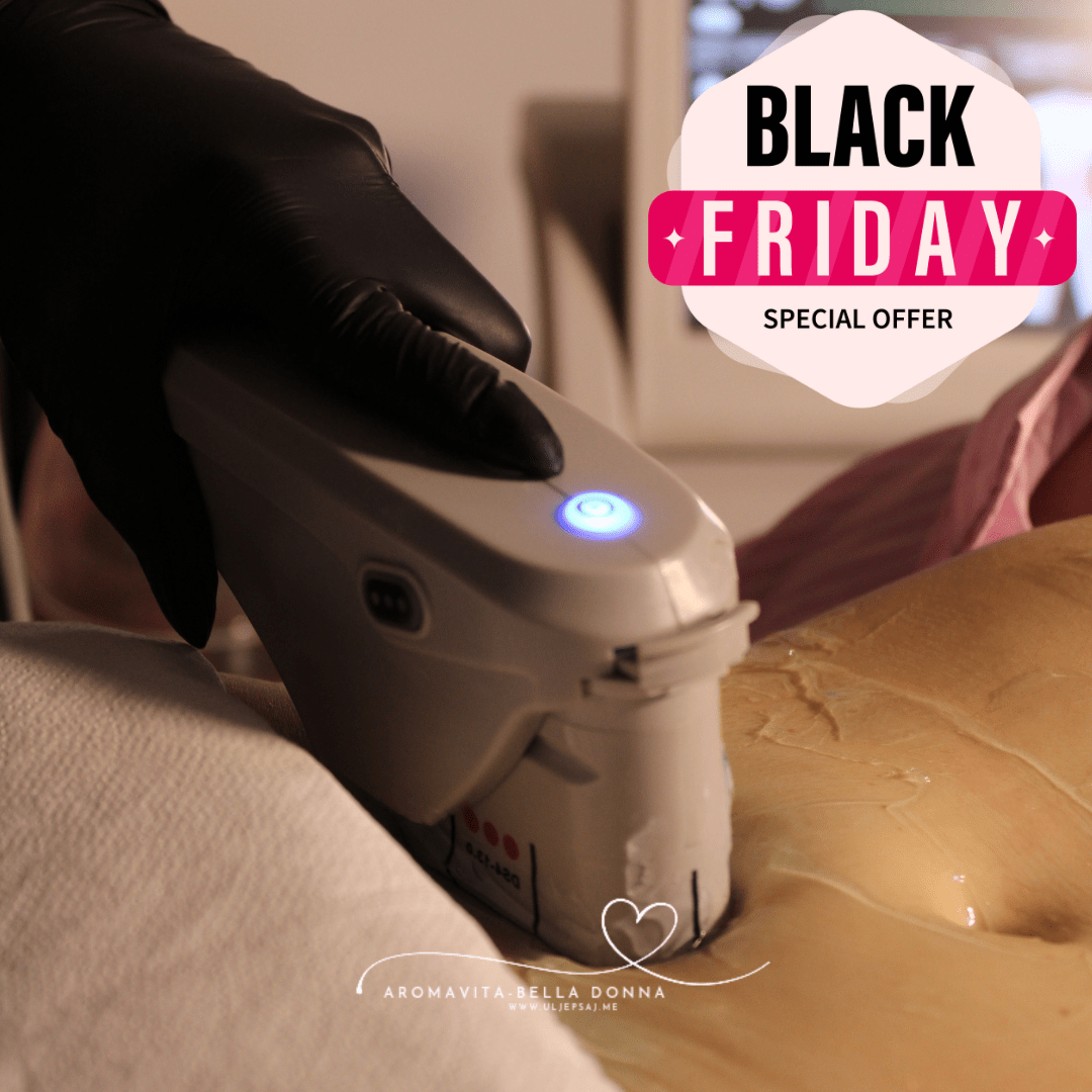 BLACK FRIDAY – HIFU Lifting (–60%)